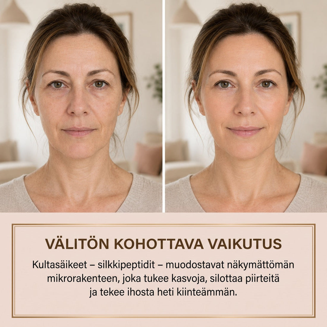 Antes e depois – efeito lifting imediato